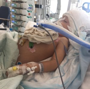 Hospital visits, transfusions, operations