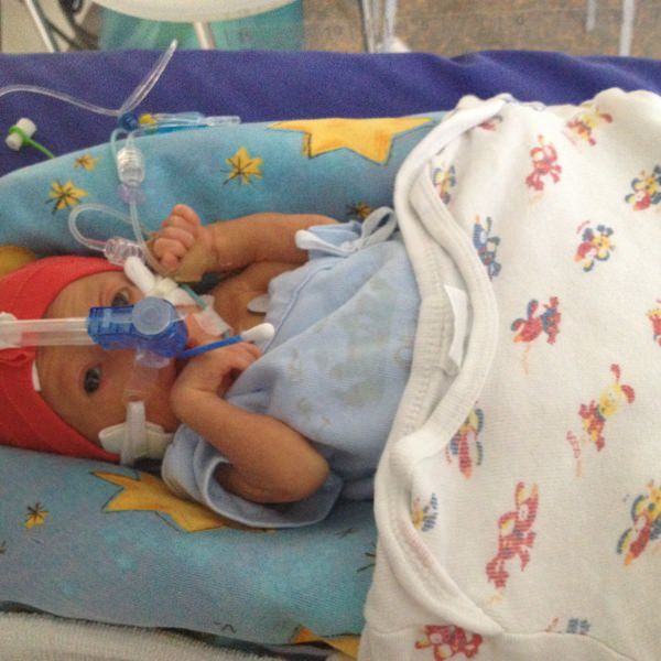 Premature born, sond feeding, early operations